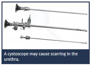 cystoscope